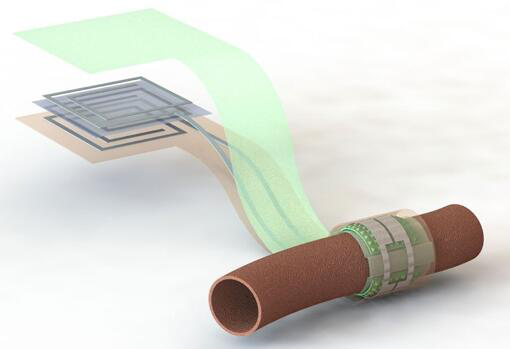 斯坦福大學(xué)開發(fā)新型可降解血流傳感器?可檢查血管是否堵塞